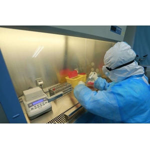 核酸分子检测的冰与火之歌：DNA vs RNA